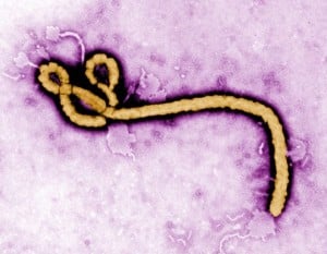 Ebola Virus/Credit: CDC